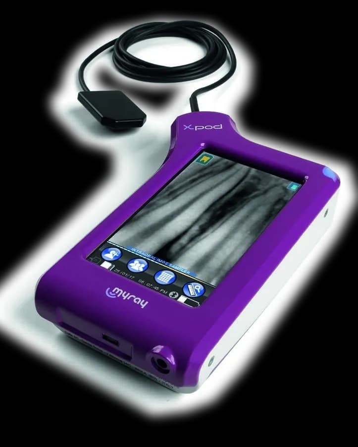 Портативный радиовизиограф MyRay X-pod с Bluetooth